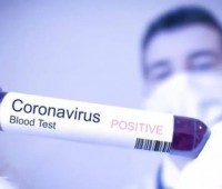 NHỮNG SỰ THẬT VỀ CORONAVIRUS BẠN CẦN BIẾT