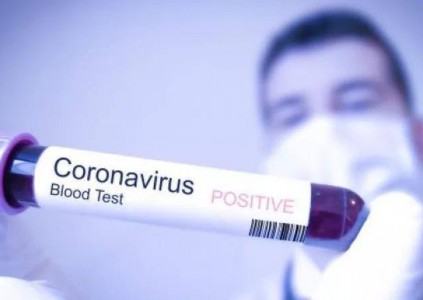 NHỮNG SỰ THẬT VỀ CORONAVIRUS BẠN CẦN BIẾT